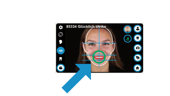 dental-camera-dentaleyepad-animation-compare-dentaleyepad-screen-front