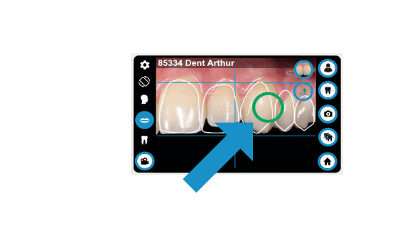 dental-camera-dentaleyepad-animation-compare-dentaleyepad-screen-tooth