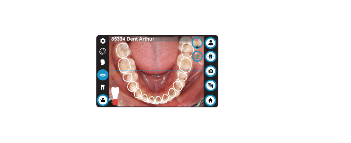dental-camera-dentaleyepad-hand-animation-screen