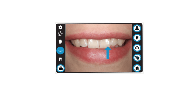 dental-camera-dentaleyepad-perfect-smile-animation-teeth-modus-01