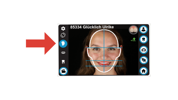 dental-camera-dentaleyepad-zoom-assistant-screen-face