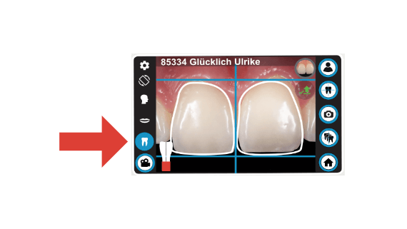 dental-camera-dentaleyepad-zoom-assistant-screen-tooth