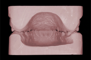 dentaleyepad Model Rückseite