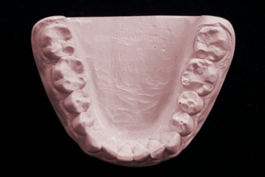 dentaleyepad Model Unterkiefer