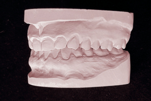 dentaleyepad Modell von links