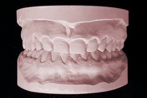 dentaleyepad Model Vorderseite
