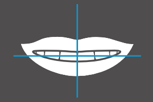 dentaleyepad overlay lächeln von vorne leicht geöffnet 2