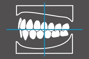 dentaleyepad-overlay-modell von links
