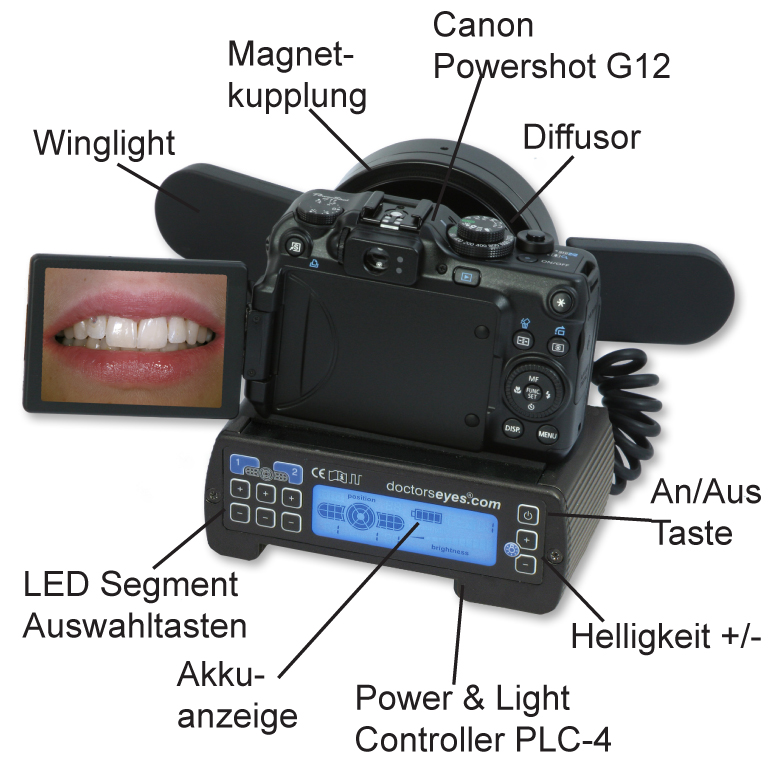 Canon PowerShot G12 - dentaleyepad