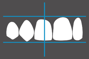 dentaleyepad overlay Oberkiefer schräg links