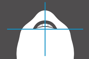 dentaleyepad overlay Portrait von 12 Uhr