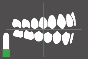 dentaleyepad overlay bukkal rechts geöffnet gespiegelt