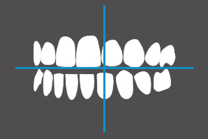 dentaleyepad overlay schräg von links geöffnet