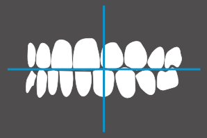 dentaleyepad overlay schräg von links geschlossen